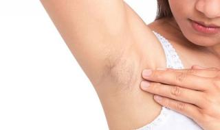 5 Thói quen khiến da vùng nách thâm đen
